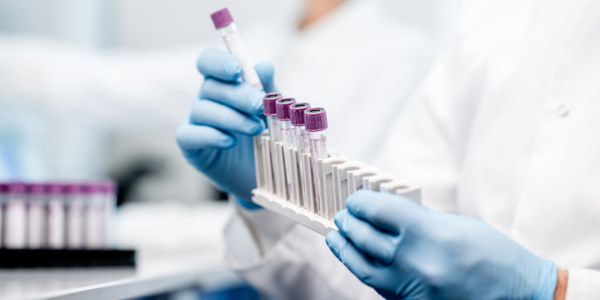 hands holding lab equipment